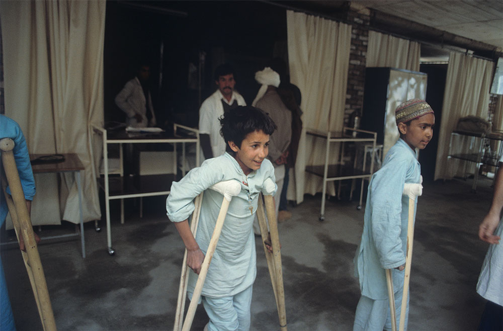 Пострадавшие от военных действий дети в госпитале Международного Красного Креста в Кабуле, 1988 год